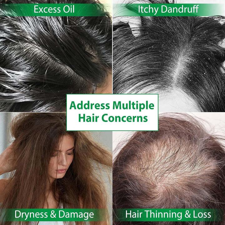 Batana Herbal Hair Growth Shampoo & Conditioner Set - Thinning Hair & Hair Loss Treatment for Women & Men, Thickening Product