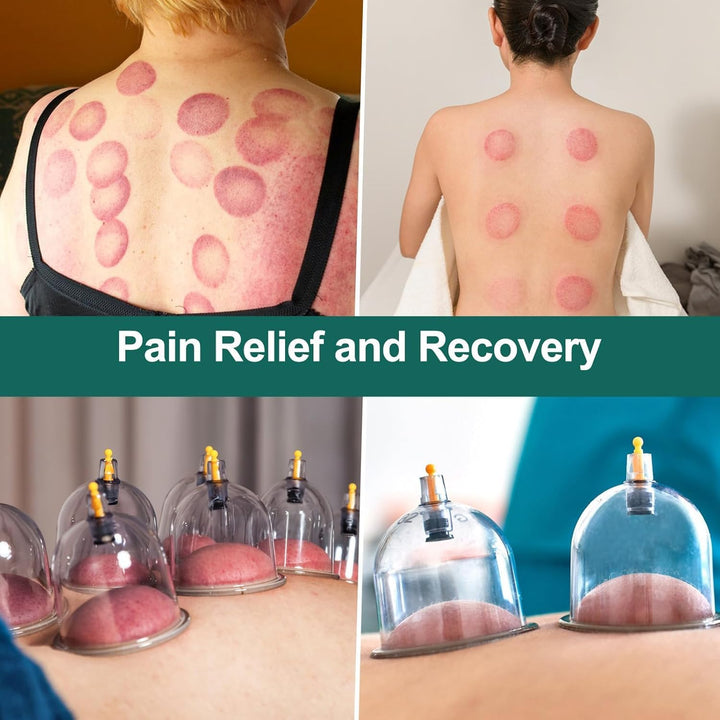 Cupping Therapy Set 20 Cups, Large Size V2.0 for Women Men Vacuum Cup for Body Muscle Back Pain Relief Massage Suck Cellulite Suction Device Cups Cupping Therapy Set