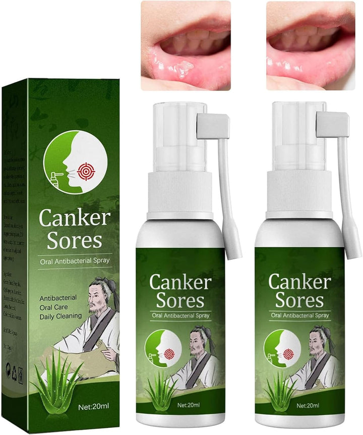Mouth Ulcer Treatment Spray,Mouth Ulcer Treatment for Adults,Canker Sore Relief Treatment,Herbal Mouths Sprays for Ulcer Treatments,Dry Mouth Relief,Breath Freshener Spray(Pack of 1)