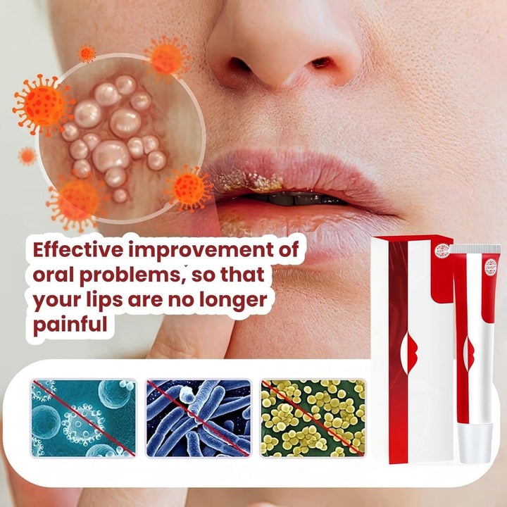 Cold Sore Cream,Gentle Cold Sore Treatment Cream,Mouth Ulcer Treatment for Adults,Gentle Sore Lips Treatment,Mouth Sore Treatment for Women and Men,Mouth Ulcer Gel,Pain Relief,Natural Ingredients