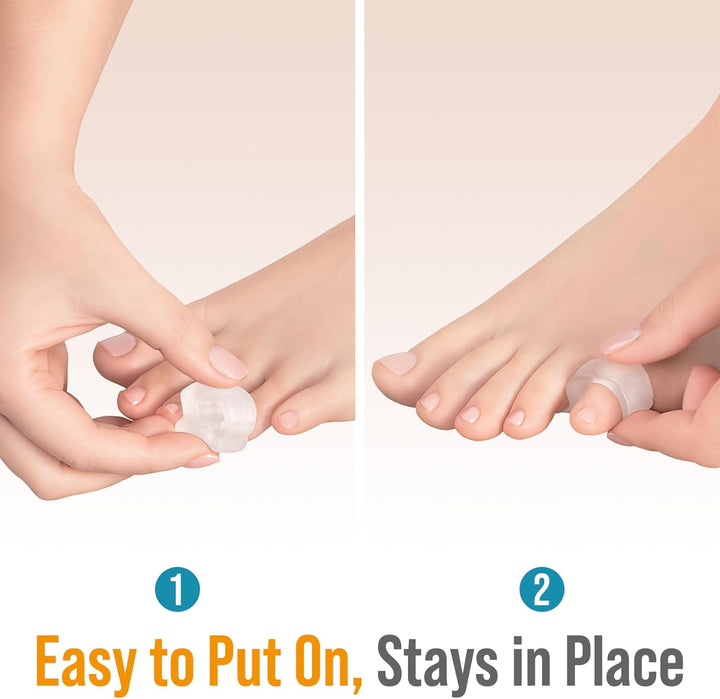 Pinky Toe Spacers for Men & Women – 4 Gel Separators for Overlapping & Curled Little Toes, Bunions, Alignment - Diabetic Foot Care, Silicone Spreader, Corrector & Straightener, Clear