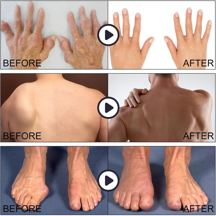 Neuropat/Hy Relief Cream,Neuropat/Hy Pain Relief for Feet,Deep Relief Gel,Quick Acting Nerve Painreliefcream for Feet Hands Shoulders Neck,Bone on Bone Knee Pain Relief,Natural Relief Cream,Knee Pain