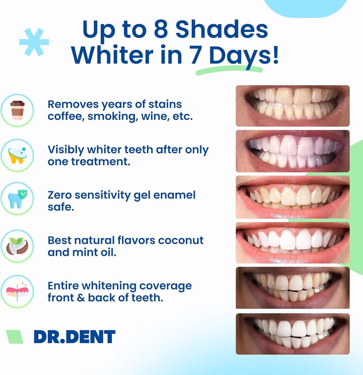 Professional Teeth Whitening Strips 21 Treatments - Safe for Enamel - Non Sensitive Teeth Whitening - Whitening without Any Harm - Pack of 42 Strips + Mouth Opener Included