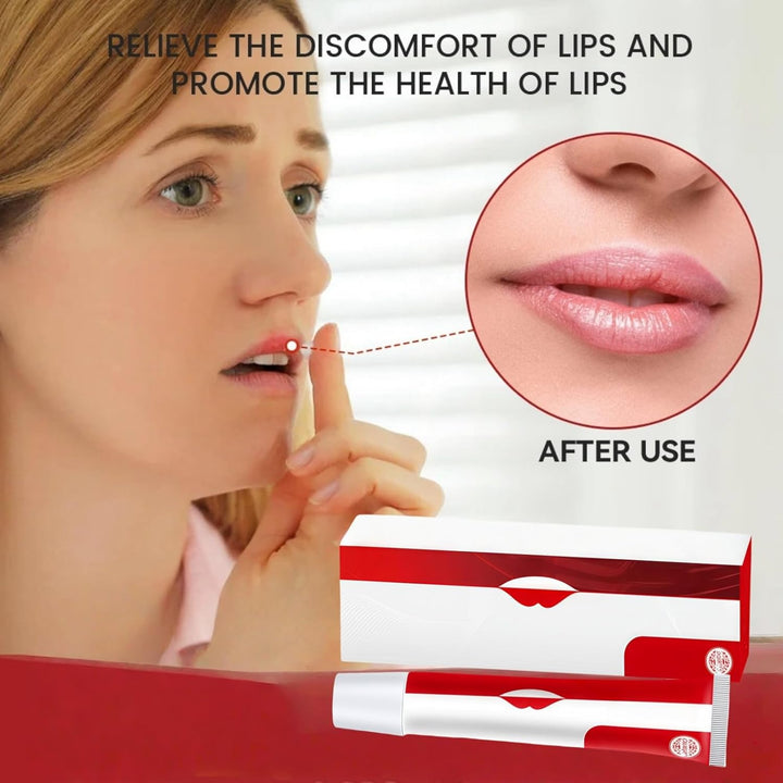 Cold Sore Cream,Gentle Cold Sore Treatment Cream,Mouth Ulcer Treatment for Adults,Gentle Sore Lips Treatment,Mouth Sore Treatment for Women and Men,Mouth Ulcer Gel,Pain Relief,Natural Ingredients